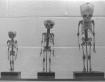 Three skeletons of children on display in the med school.